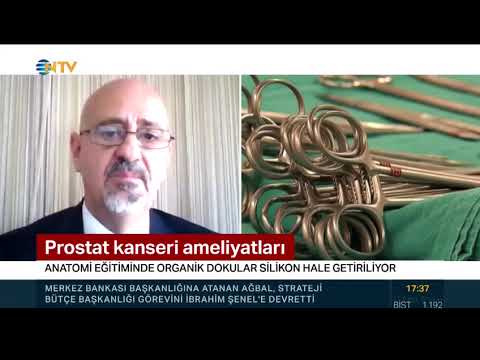 Prostat Kanseri ve Plastinasyon NTV Ana Haber