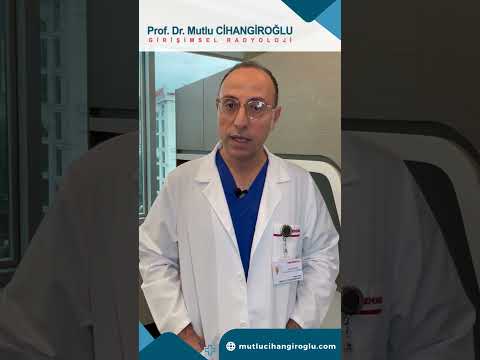 MİYOM EMBOLİZASYONU NASIL UYGULANIR?