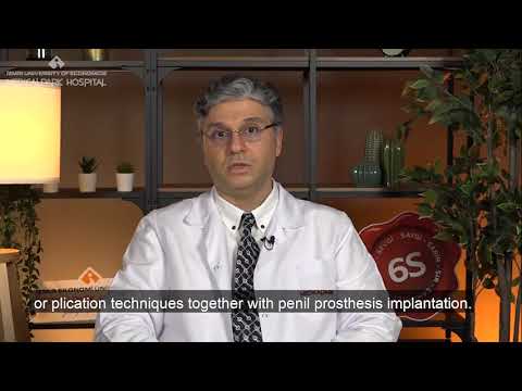 What is the diagnosis and treatment of peyronie’s disease?