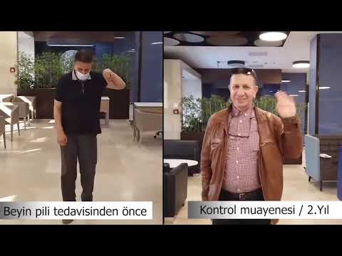 Parkinson hastası Abderrezek Laouchria'nın Beyin Pili tedavisi 2.yıl görüntüleri | Doç. Dr. Ali ZIRH