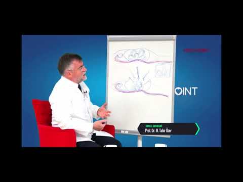 LAPAROSKOPİK (KAPALI) AMELİYAT NEDİR ?
