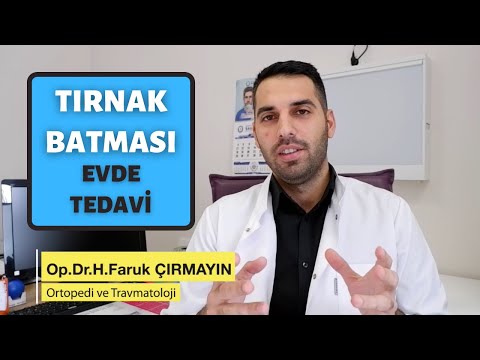 Tırnak Batması 6 Etkili Yöntem ile Evde Tedavi