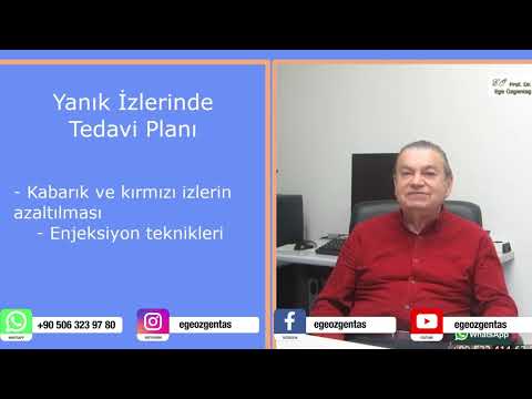 Yanık İzi Tedavisi Ve Yöntemleri