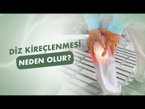 Diz Kireçlenmesi Tedavisi Nasıl Yapılır?