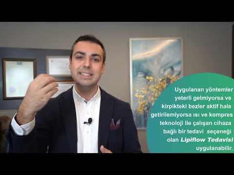 KURU GÖZ HASTALIĞI VE TEDAVİSİ
