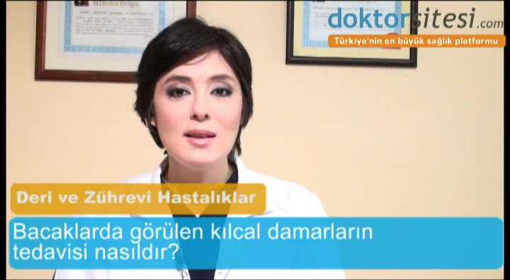 Bacaklarda görülen kılcal damarların tedavisi nasıldır?