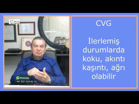 CVG (Cutis Verticis Gyrata) Hastalığı