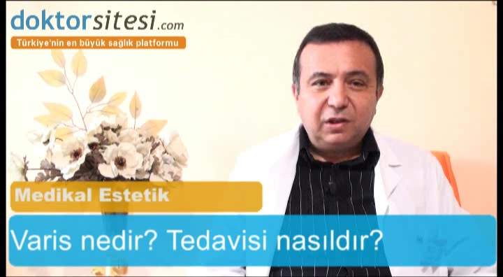 Varis nedir? Tedavisi nasıldır?
