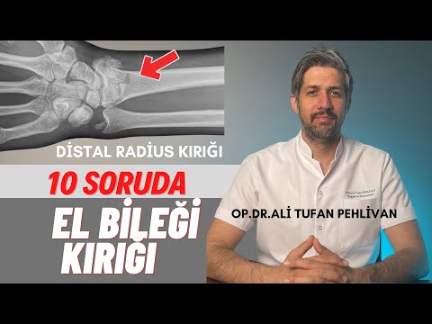 El Bileği Kırığı Nedir// El Bileği Kırığı Nasıl Tedavi Edilir?