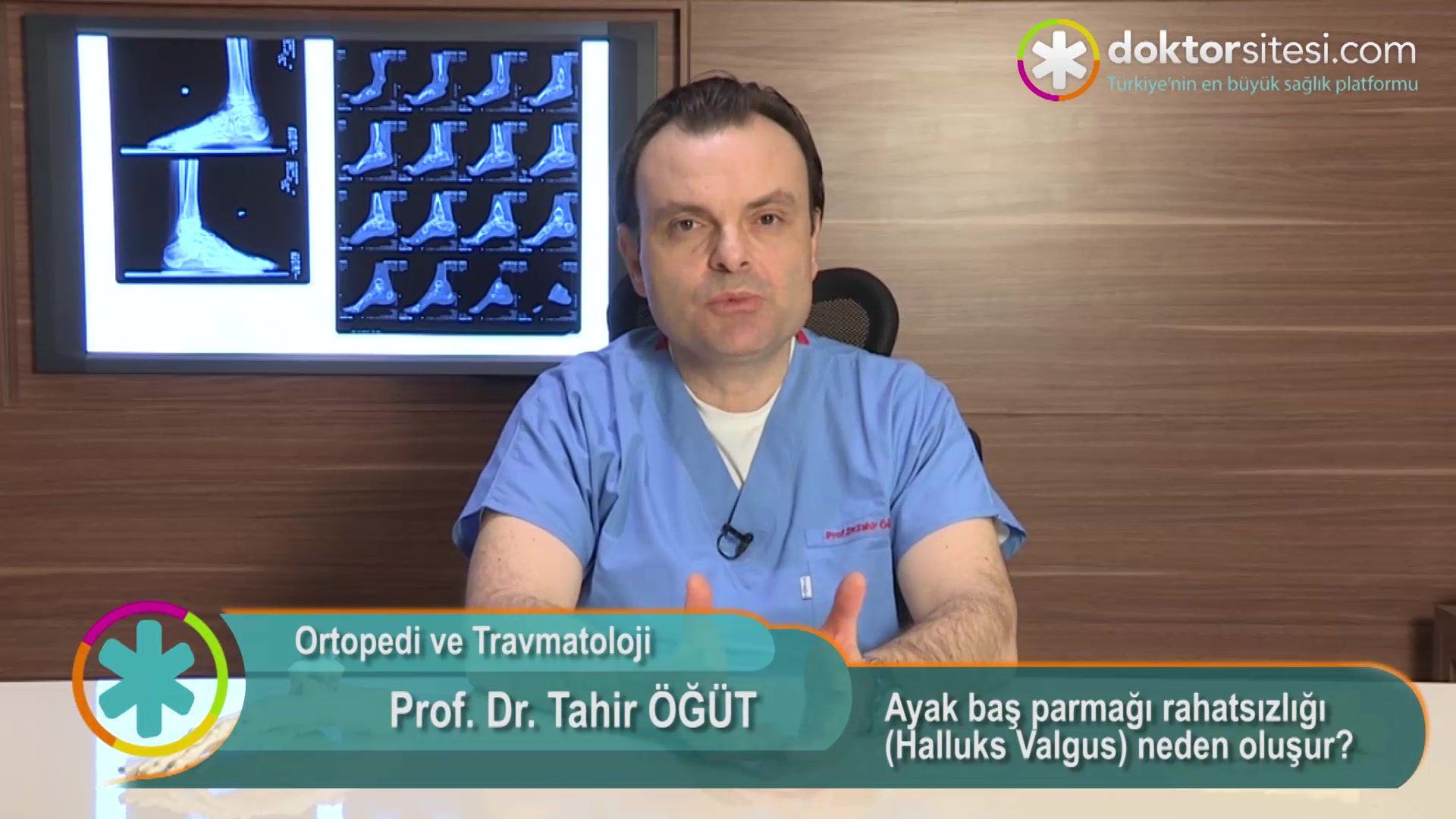 Ayak baş parmağı rahatsızlığı (Halluks Valgus) neden oluşur?
