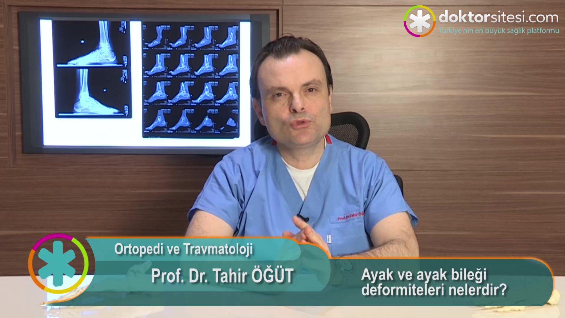 Ayak ve ayak bileği deformiteleri nelerdir?