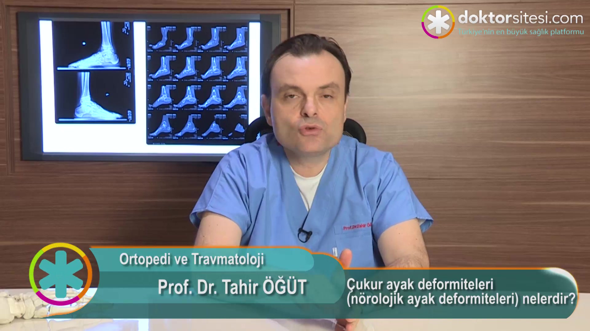 Çukur ayak deformiteleri (nörolojik ayak deformiteleri) nelerdir?
