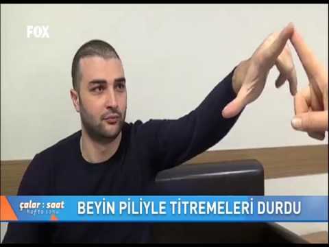 25 yaşındaki Deniz Koçal beyin pili sayesinde küçüklüğünden bu yana yaşadığı titremelerden kurtuldu