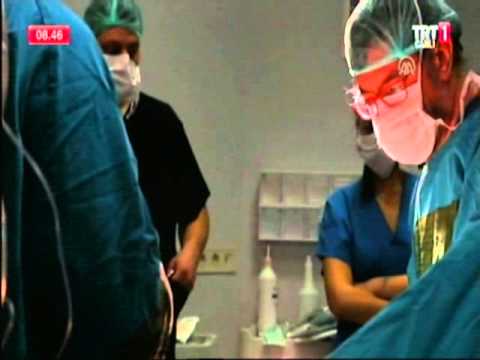 Güldüren Liposuction | Prof.Dr.Eksal KARGI Trt1 Haber