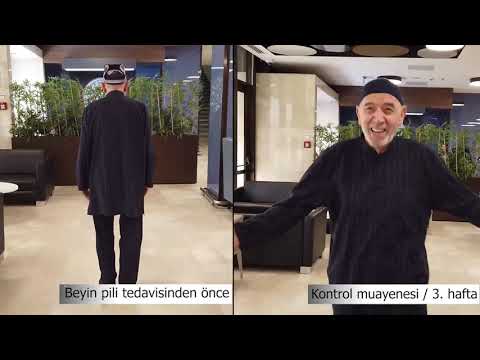 Parkinson hastası Adiljon Isakhanov'un Beyin Pili ile Değişimi | Doç. Dr. Ali ZIRHParkinson hastası Adiljon Isakhanov'un Beyin Pili ile Değişimi | Doç. Dr. Ali ZIRH