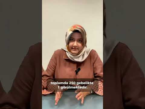 💫Çift ve tek yumurta ikizleri, ikizlik türleri arasında önemli farklılıklar gösterir.