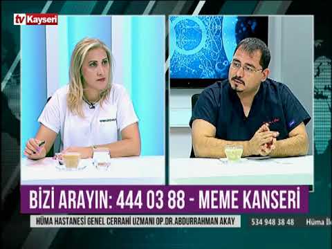 Meme Kanseri-Dr.Abdurrahman Akay