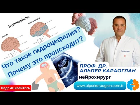 Что такое гидроцефалия? Почему это происходит? | Проф. Др. Альпер КАРАОГЛАН