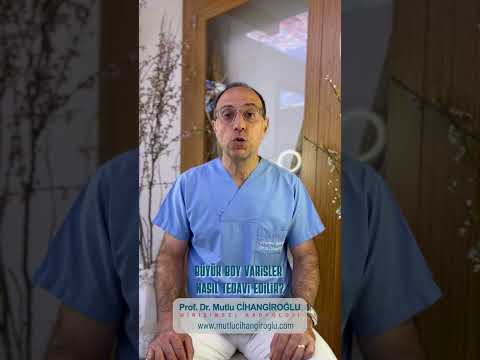 BÜYÜK BOY VARİS NASIL TEDAVİ EDİLİR?