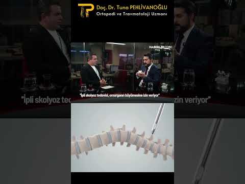 İpli Skolyoz (Bantla Gerdirme-Vertebral Body Tethering) Ameliyatının Avantajları Nelerdir?
