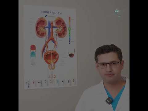 Böbrek taşları hakkında merak edilenler 2