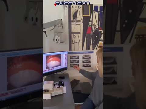 Lipiflow ve IPL desteği ile LaserPrimeCare