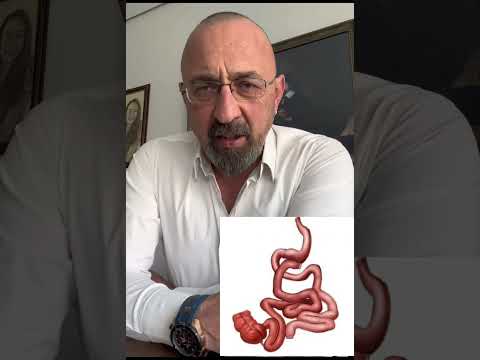 Hangi obezite ameliyatında ne yapıyoruz? Obezite cerrahisi, bariatrik cerrahi, metabolik cerrahi