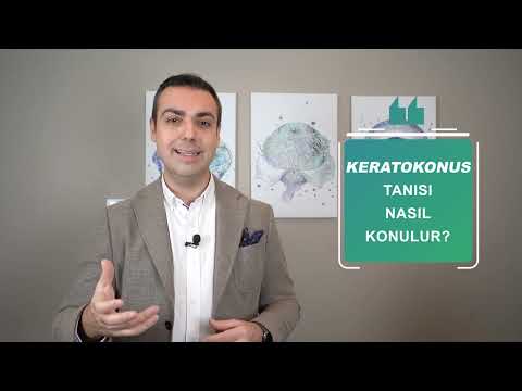 KERATOKONUS NEDİR? BELİRTİLERİ VE TEDAVİSİ