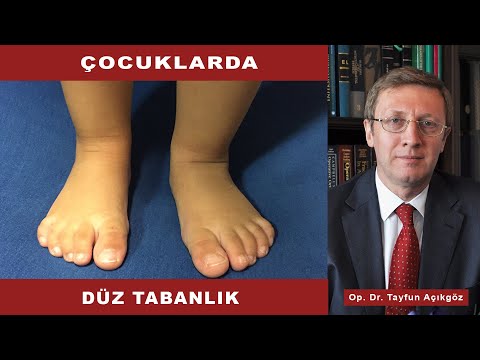 Çocuklarda Düz Tabanlık - Op. Dr. Tayfun Açıkgöz