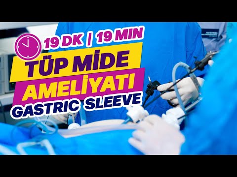 Tüp Mide Ameliyatı ( 19 Dakikada & Sadece 3 Delikten ) Gastric Sleeve | Obezite Cerrahisi