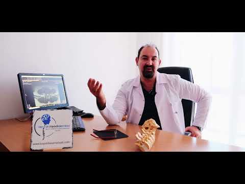 Bel Fıtığına Ameliyatsız Çözüm