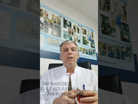 SAFRA TAŞLARI