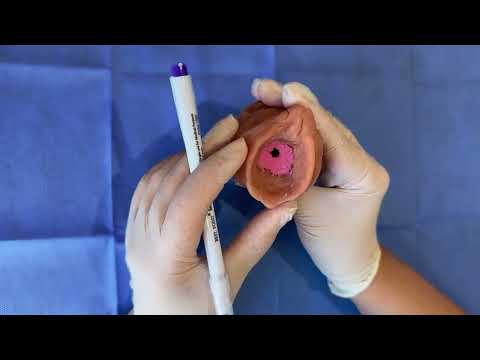 Kızlık Zarı Nedir ? Ne İşe Yarar ? - Doktor İrem Yengel