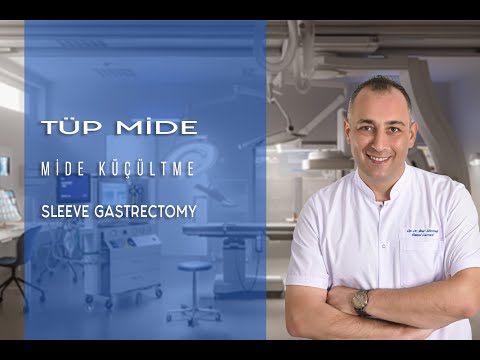 Tüp Mide ( Mide Küçültme - Sleeve Gastrectomy )