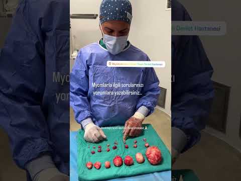 📌 Myomlarla İlgili Sorularınızı Yorumlara Yazabilirsiniz - Abdulkadir Güllüce Op.Dr