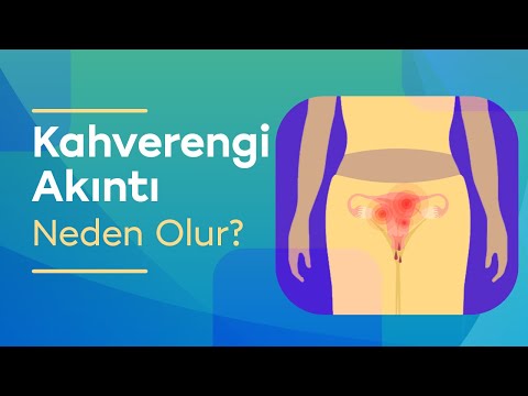 Kahverengi Akıntının Fizyolojik ve Patolojik Nedenleri Nelerdir? Kahverengi Akıntı Tedavisi