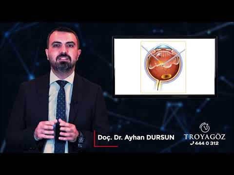Doç. Dr. Ayhan DURSUN Diyanetik Diyabetik Retinopati Nedir ?