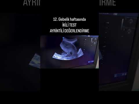 İkili Test Ayrıntılı Değerlendirme 🫃🏼