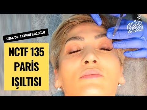 NCTF Paris Işıltısı | Uzm. Dr. Tayfun KOÇOĞLU