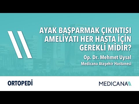 Ayak Başparmak Çıkıntısı Ameliyatı Her Hasta İçin Gerekli Midir? – Op. Dr. Mehmet Uysal