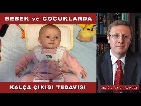 Bebeklerde Kalça Çıkığı Tedavisi - Op. Dr. Tayfun Açıkgöz