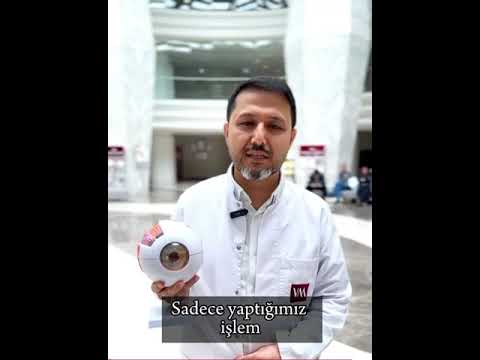 Akıllı Mercek