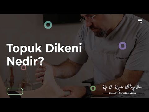 Topuk Dikeni Nedir?
