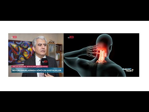 Boyun fıtığı ve boyunda kanal darlığı- Prof. Dr. Bülent DÜZ