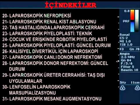 Textbook of Laparoscopic Urology - Dr. Inderbir S. Gill & Professor Doctor Mete KİLCİLER