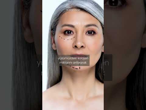 Yüzdeki Sarkmaların Önüne Geçmek Mümkün Mü?