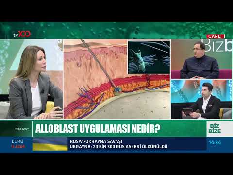 Dermatolog Uzm. Dr. Ahmet Berk ( Alloblast Nedir )