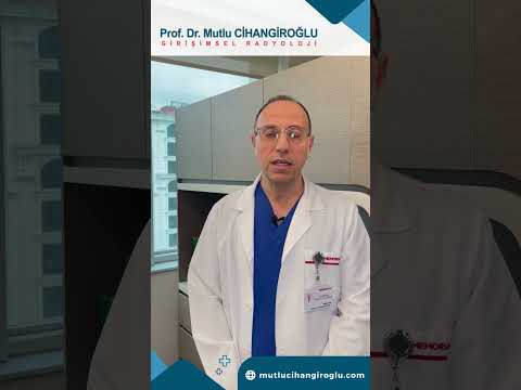 MİYOM NEDİR?