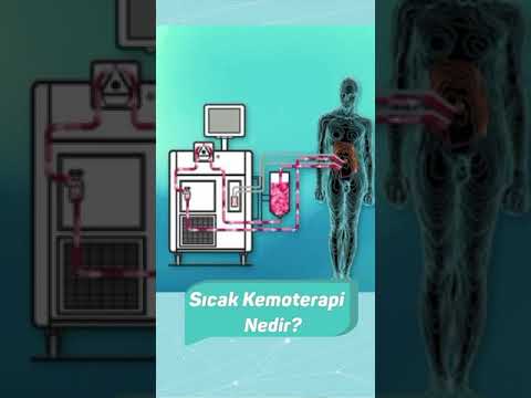 Sıcak Kemoterapi Nedir ? Prof. Dr. Emel CANBAY