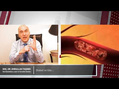 Diabet ve Göz